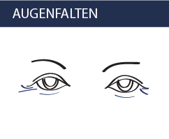 Augenfalten