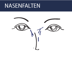 Nasenfalten