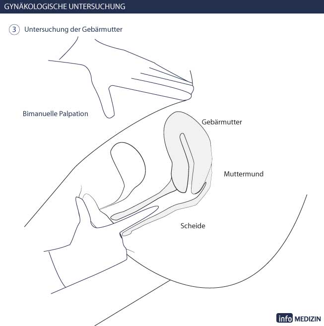 Gynäkologische Untersuchung - bimanuelle Tastuntersuchung