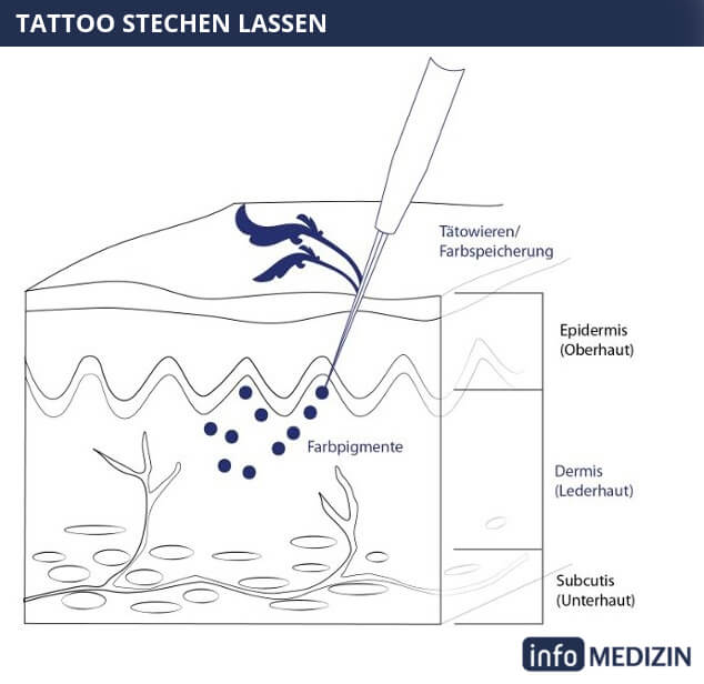 Tattoo stechen lassen