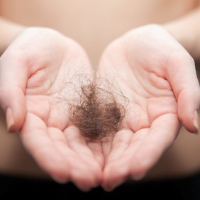 ausgefallene Haare in der Hand